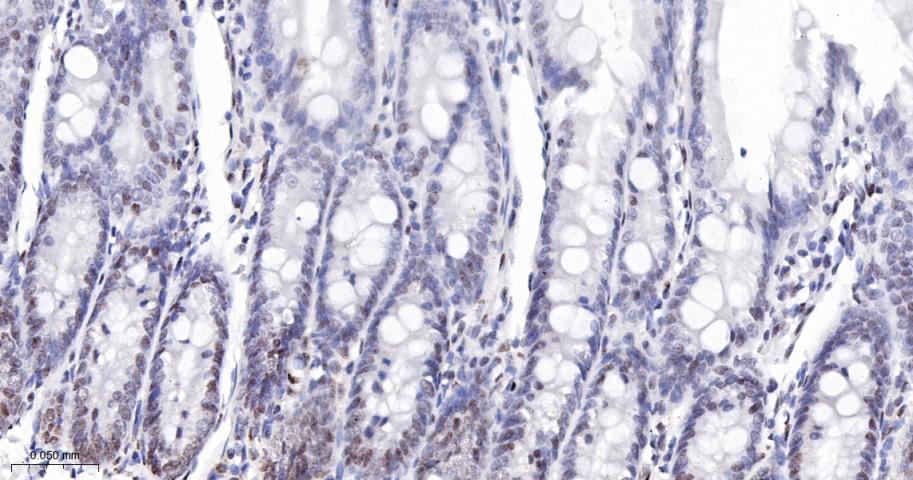 磷酸化信号转导和转录激活因子3重组兔单抗