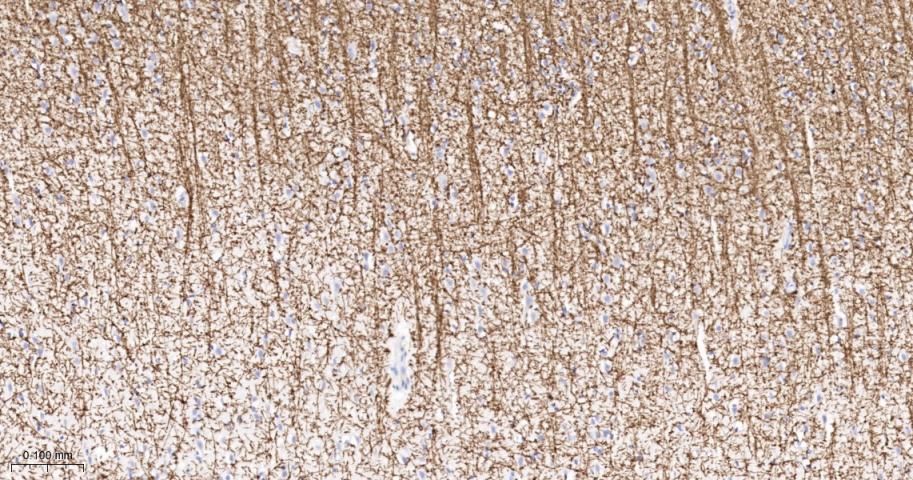 髓鞘少树突胶质细胞糖蛋白重组兔单抗