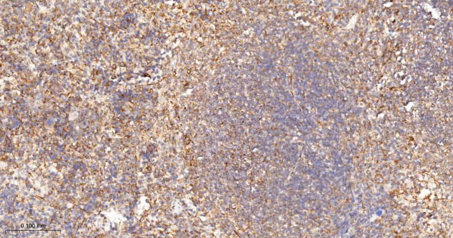 血管内皮生长因子受体1重组兔单抗