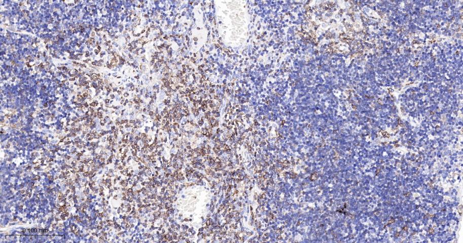 白细胞F肌动蛋白结合蛋白重组兔单抗