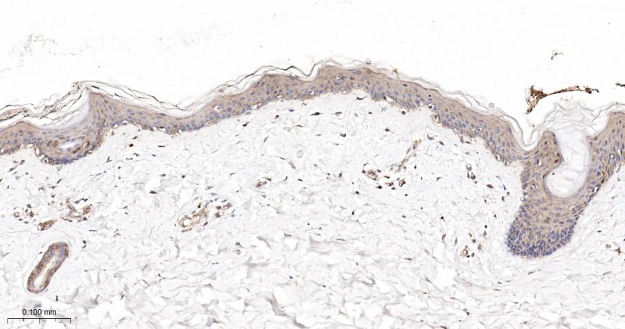 p21激活激酶2重组兔单抗