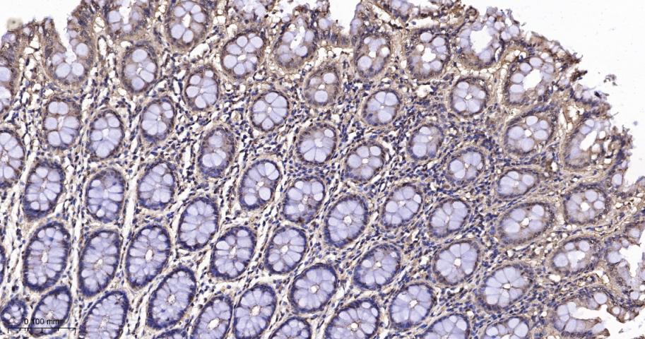 p21激活激酶2重组兔单抗