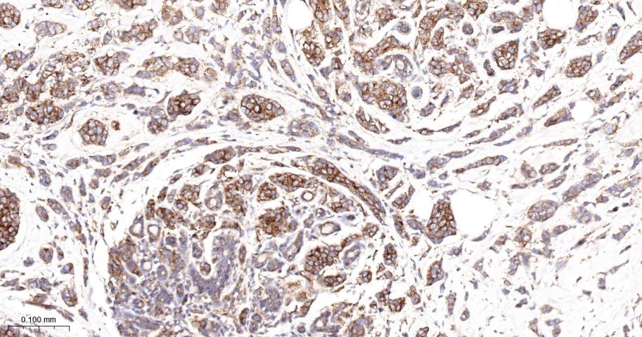 血管内皮生长因子受体1重组兔单抗