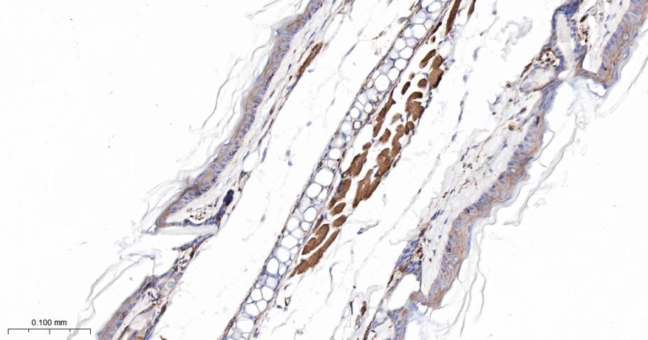 网蛋白重组兔单抗