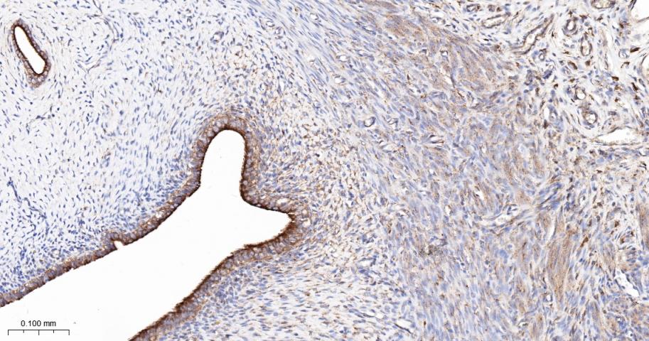 血管内皮生长因子受体1重组兔单抗