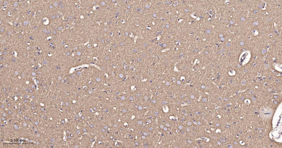 肾上腺素能受体β2重组兔单抗