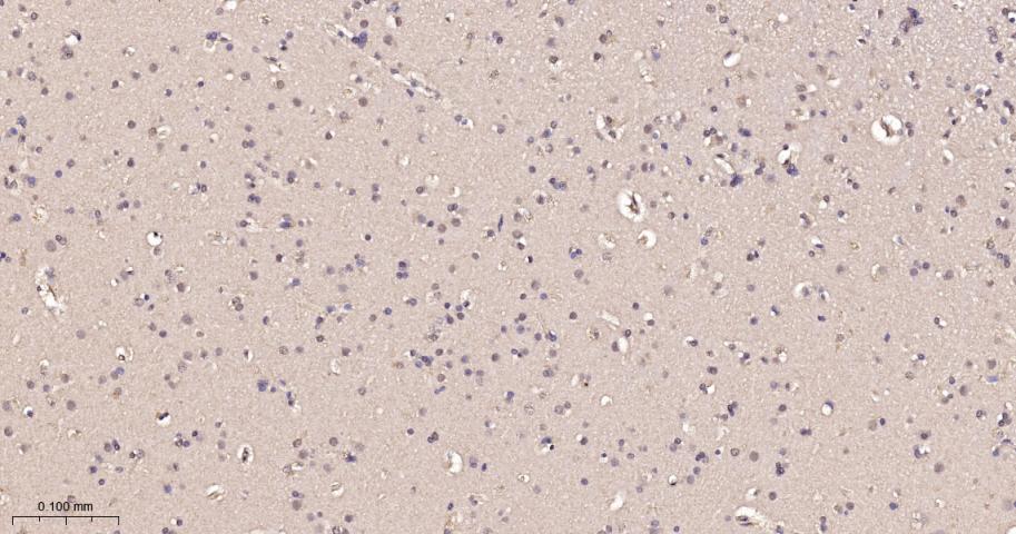 p21激活激酶2重组兔单抗