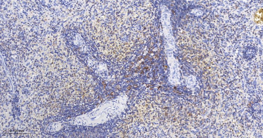 白细胞F肌动蛋白结合蛋白重组兔单抗