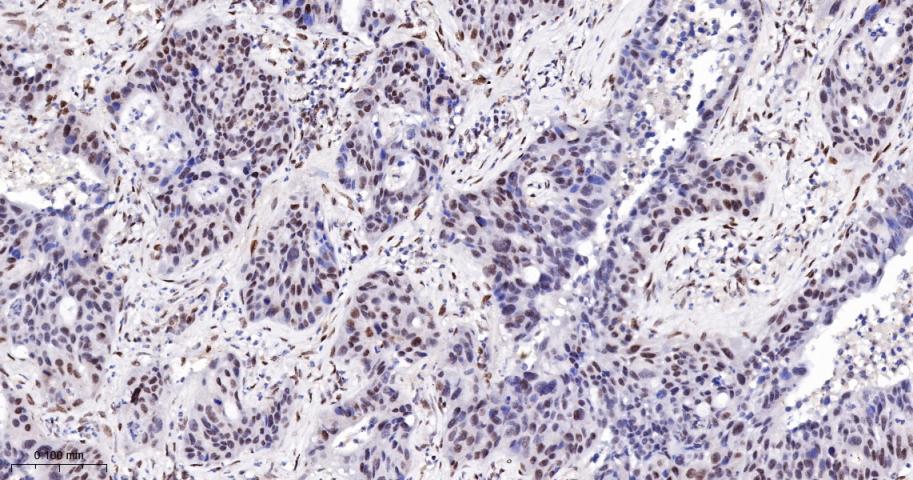 磷酸化信号转导和转录激活因子3重组兔单抗