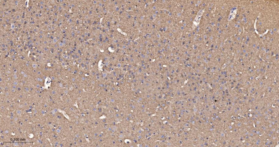 肾上腺素能受体β2重组兔单抗