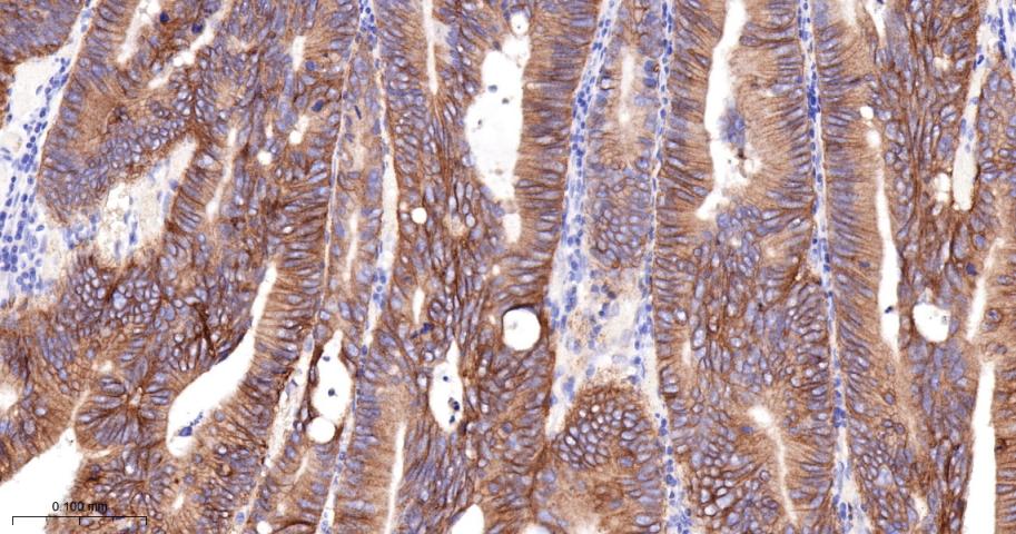 整合素β4重组兔单抗
