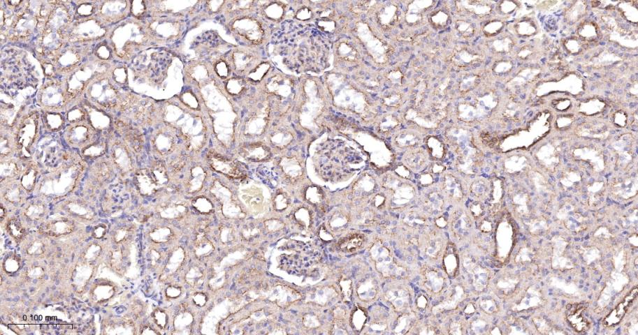 血管内皮生长因子受体1重组兔单抗