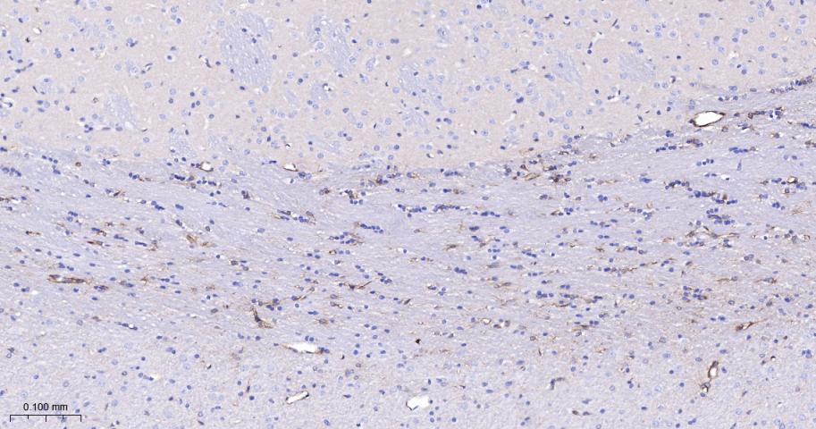 网蛋白重组兔单抗