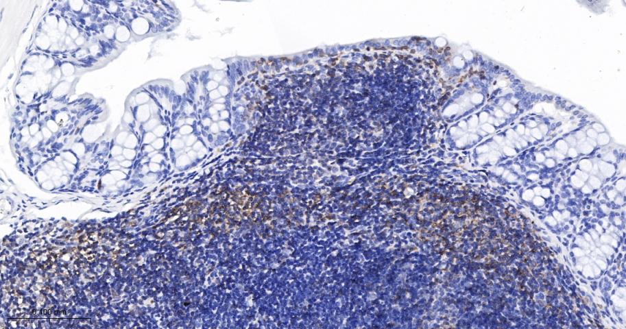 白细胞F肌动蛋白结合蛋白重组兔单抗