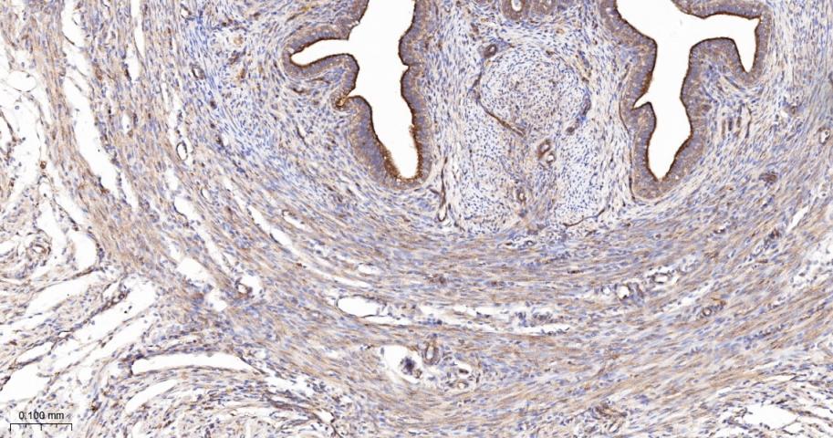 血管内皮生长因子受体1重组兔单抗