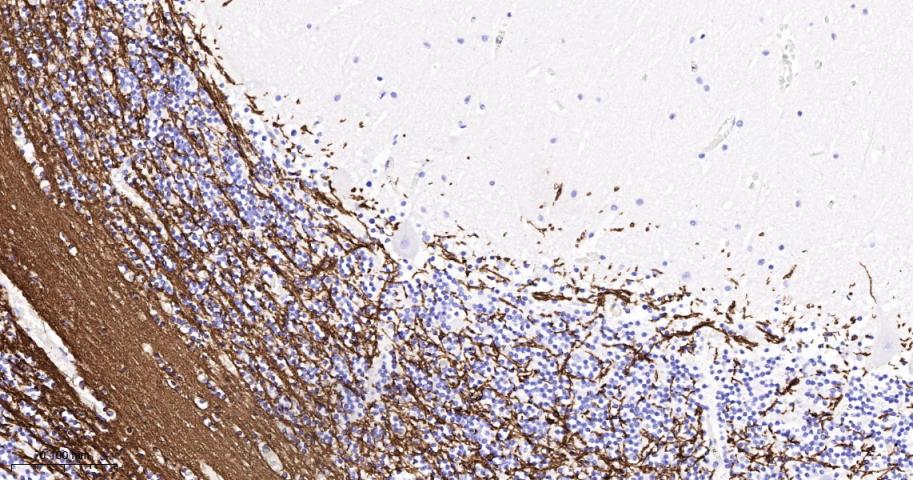 髓鞘少树突胶质细胞糖蛋白重组兔单抗