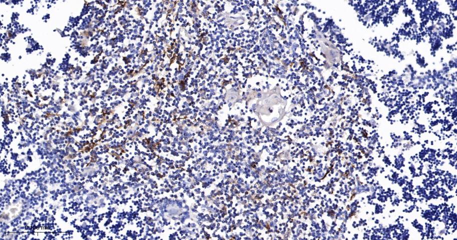 白细胞F肌动蛋白结合蛋白重组兔单抗