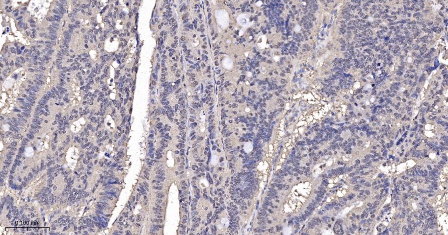 p21激活激酶2重组兔单抗