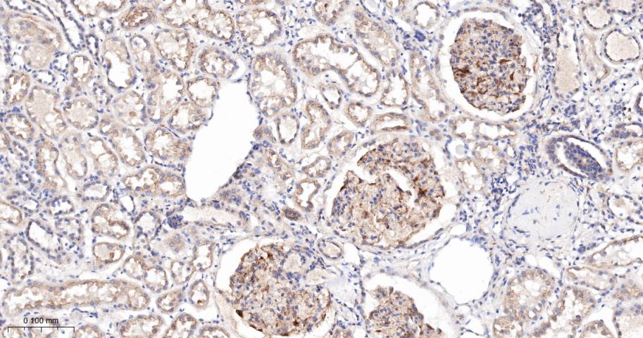 血管内皮生长因子受体1重组兔单抗