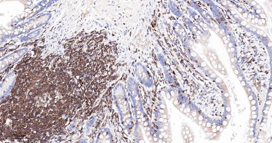 白细胞F肌动蛋白结合蛋白重组兔单抗