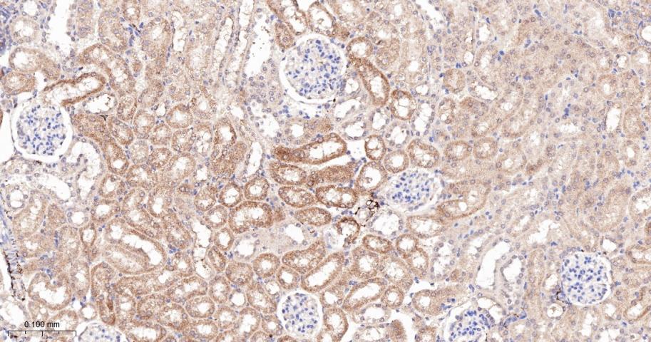 G蛋白偶联受体6重组兔单抗