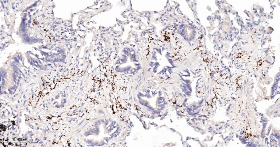 G蛋白偶联受体6重组兔单抗