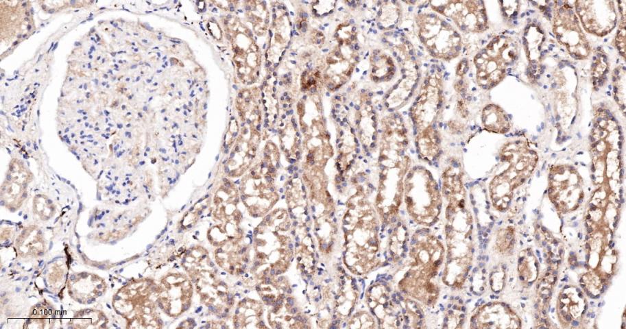 G蛋白偶联受体6重组兔单抗