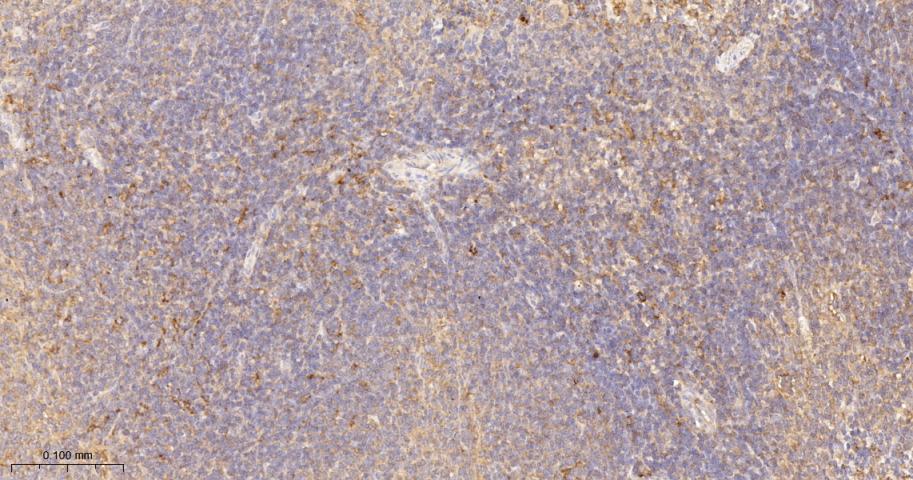 KB抑制蛋白激酶γ重组兔单抗