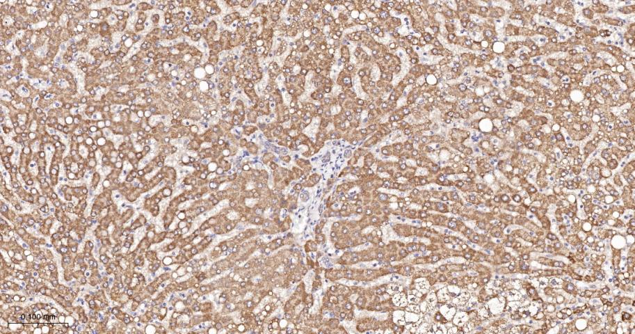 KB抑制蛋白激酶γ重组兔单抗