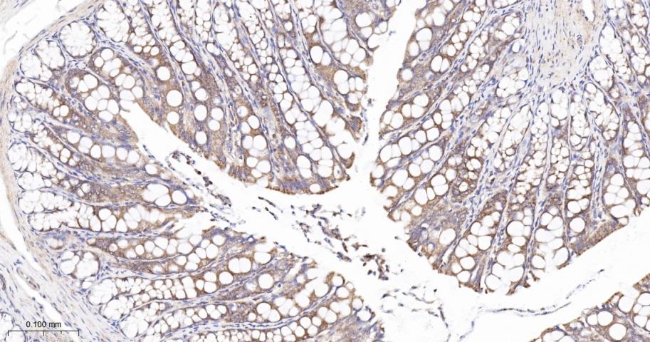 KB抑制蛋白激酶γ重组兔单抗