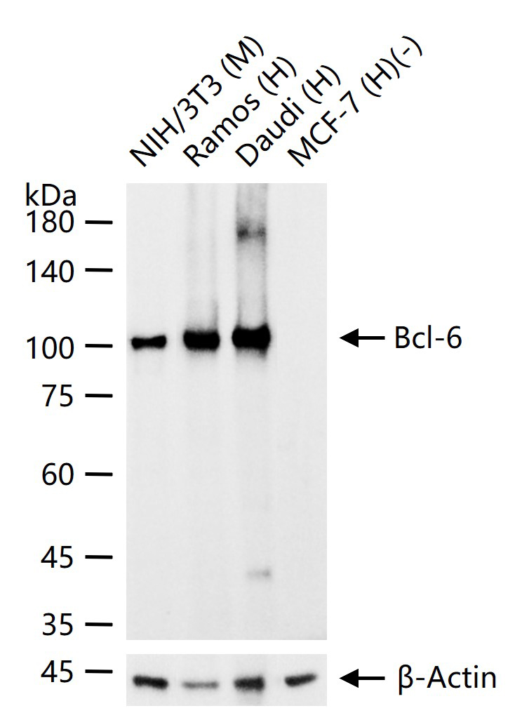 Bcl-6 Rabbit pAb (一抗) - WB,IHC-P,IHC-F,IF,ELISA | Bioss