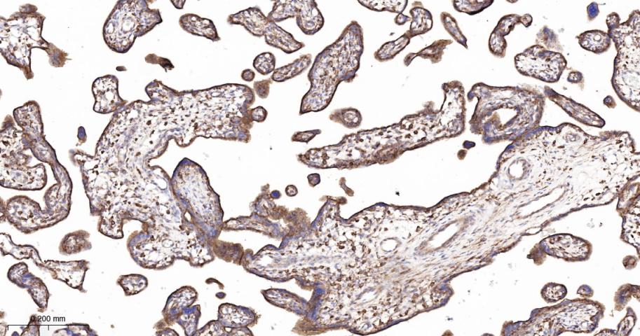 血管内皮生长因子受体1重组兔单抗