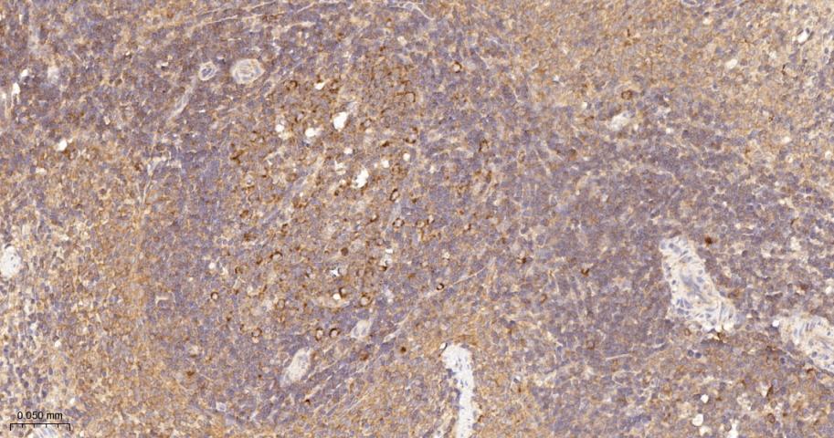 KB抑制蛋白激酶γ重组兔单抗