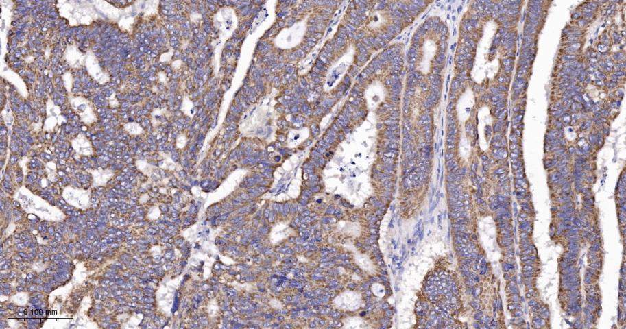 KB抑制蛋白激酶γ重组兔单抗
