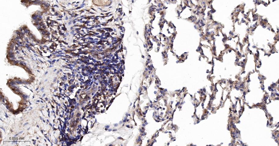 KB抑制蛋白激酶γ重组兔单抗