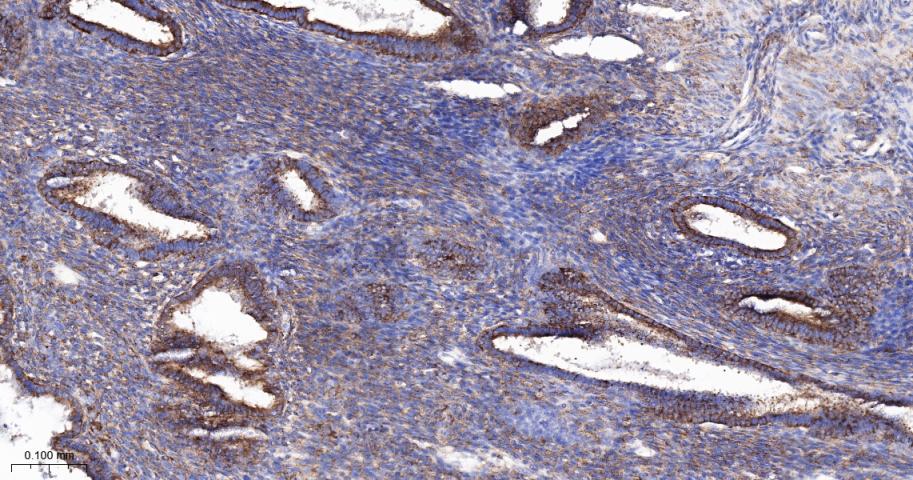 血管内皮生长因子受体1重组兔单抗