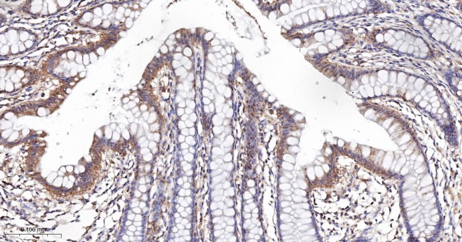 KB抑制蛋白激酶γ重组兔单抗