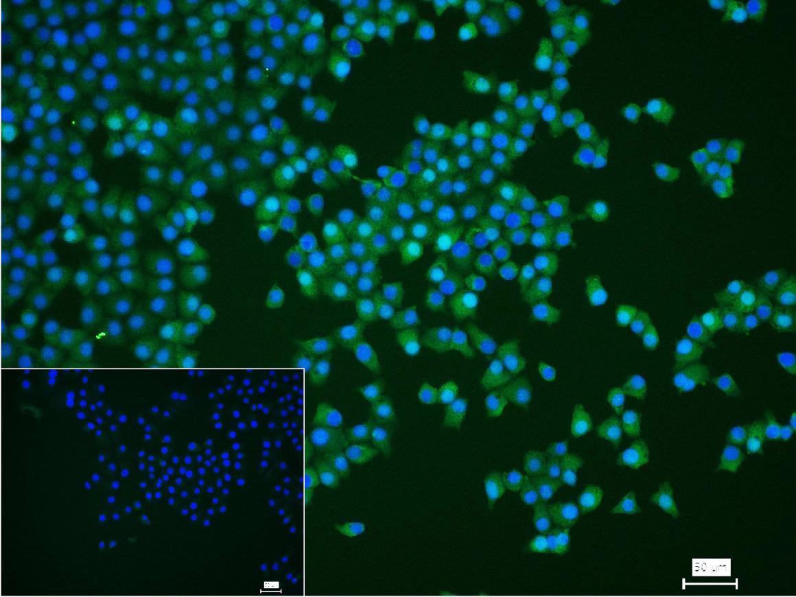 硫氧还蛋白重组兔单抗-bsm-63003R
