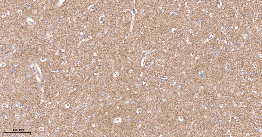 血管内皮生长因子受体1重组兔单抗