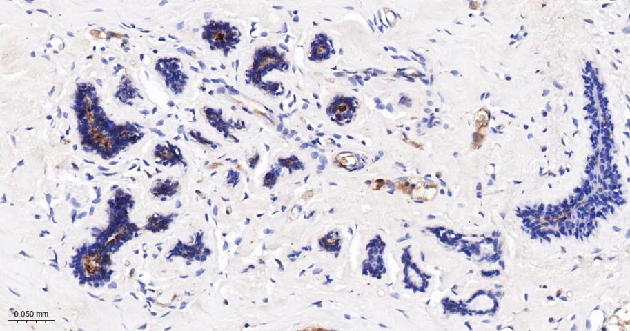 G蛋白偶联受体6重组兔单抗