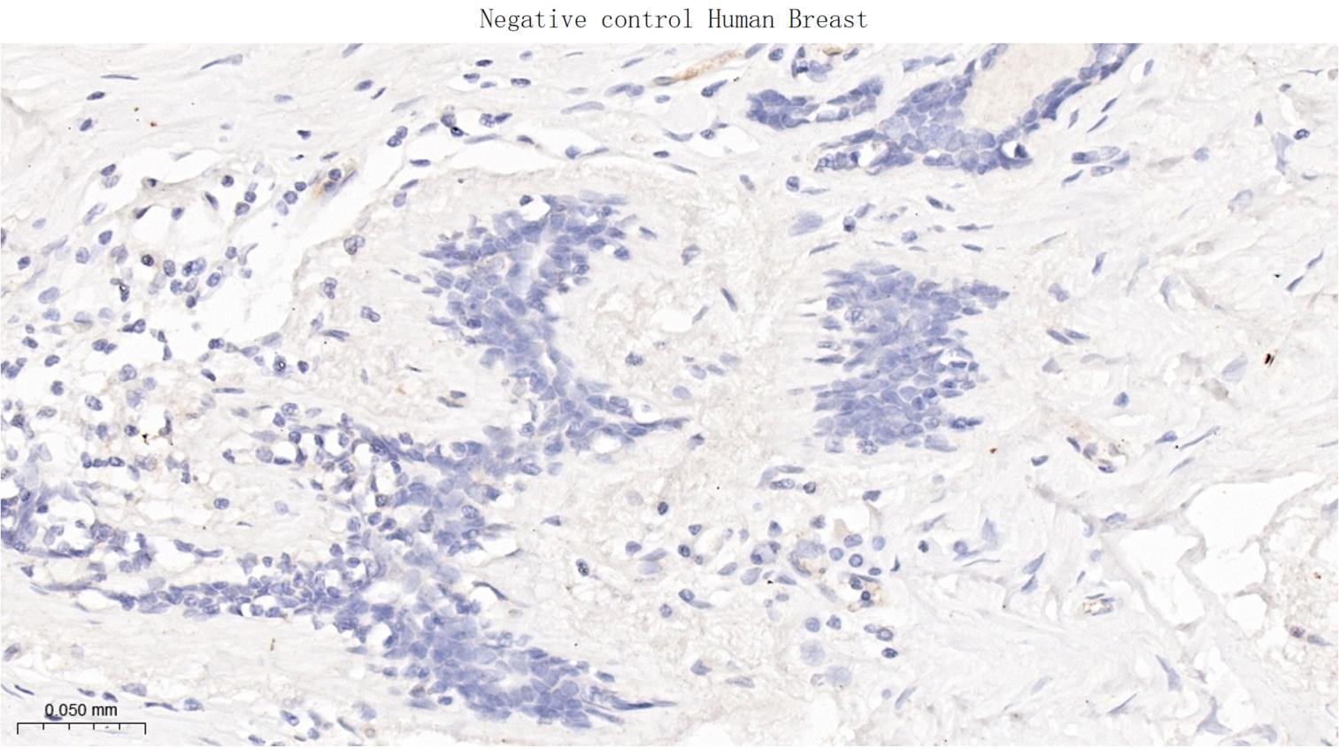 细胞肿瘤抗原P53重组兔单抗