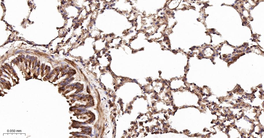 KB抑制蛋白激酶γ重组兔单抗