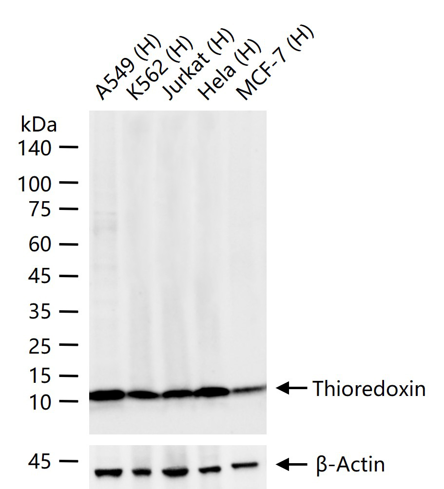 Thioredoxin Recombinant Rabbit mAb (一抗) - WB,IHC-P,IHC-F,IF,ICC/IF,IP | Bioss