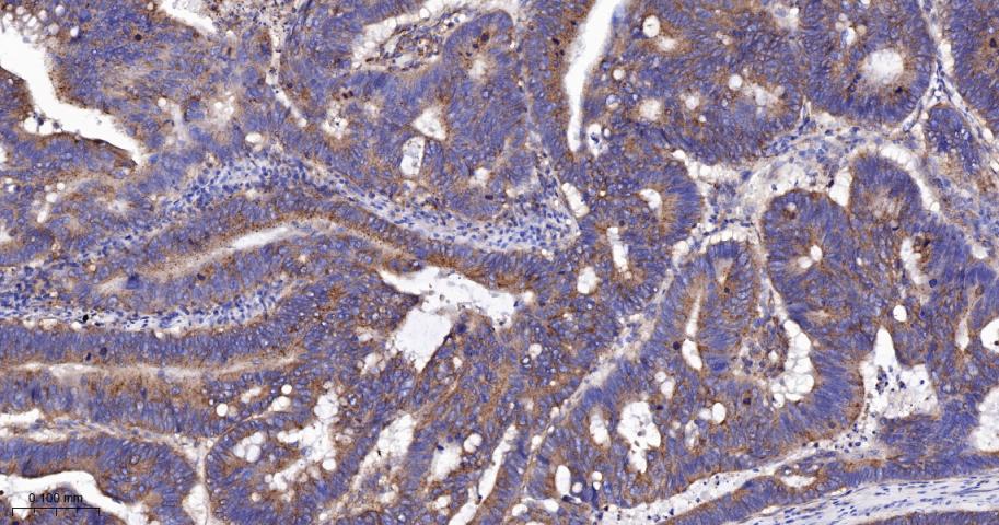 血管内皮生长因子受体1重组兔单抗