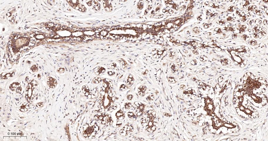 KB抑制蛋白激酶γ重组兔单抗