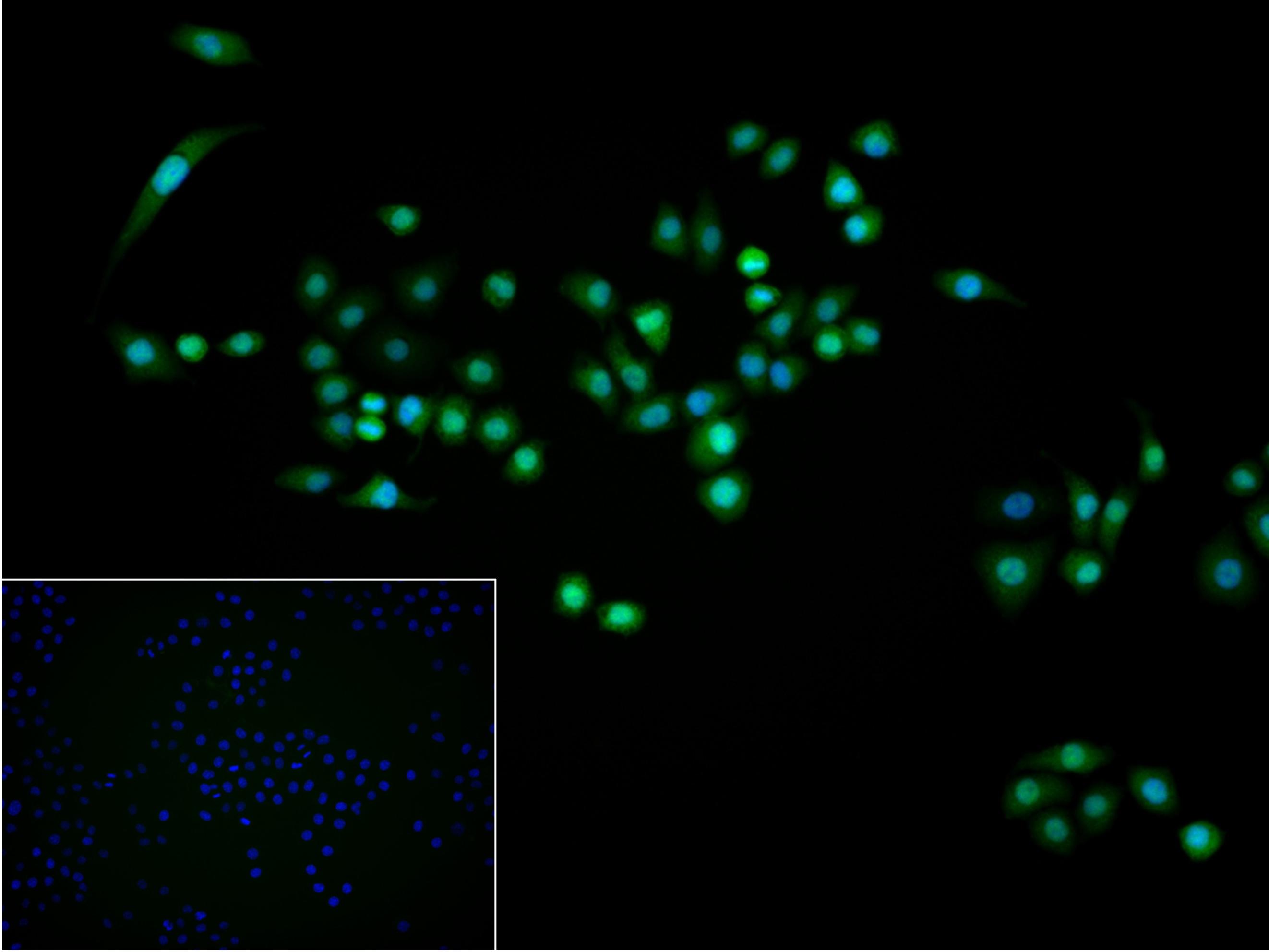 抑癌基因p16重组兔单抗