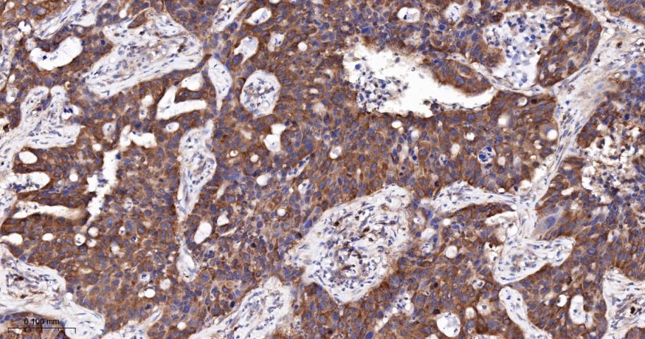 G蛋白偶联受体6重组兔单抗