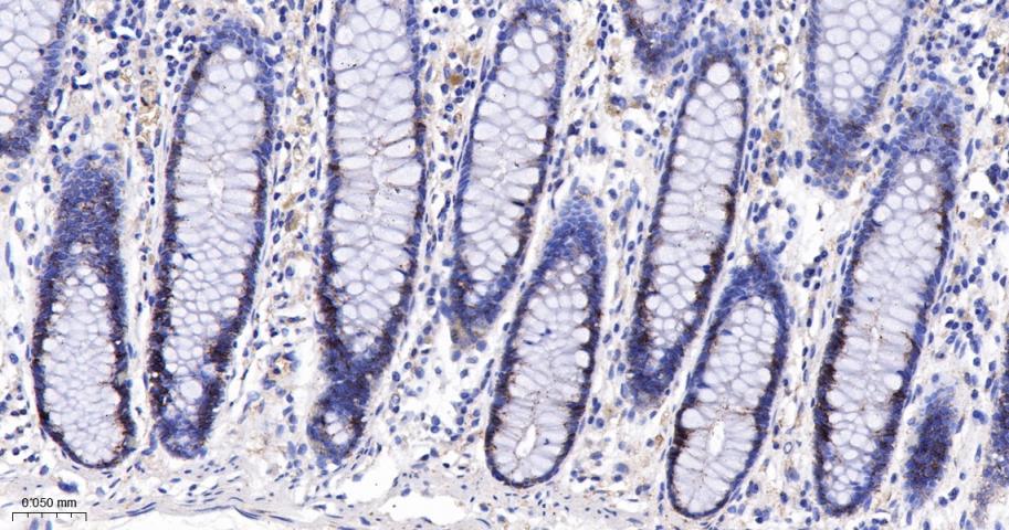 肾上腺素能受体β2重组兔单抗