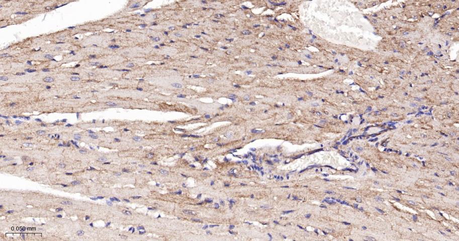 肾上腺素能受体β2重组兔单抗