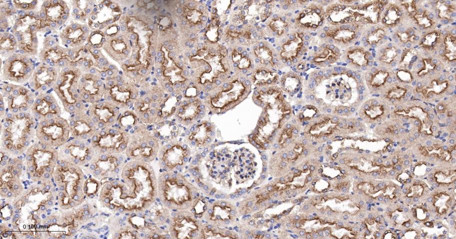 肾上腺素能受体β2重组兔单抗